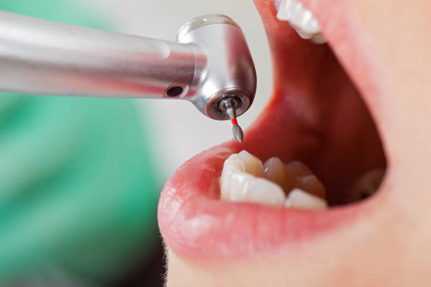 Best Urgent Care for Lost Fillings or Crowns in St Elmo, IL